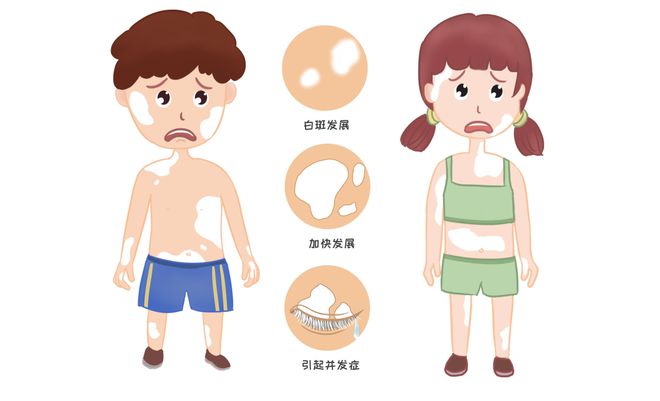 南阳白癜风医院-如何才能有效防止白癜风扩散呢?(图1)